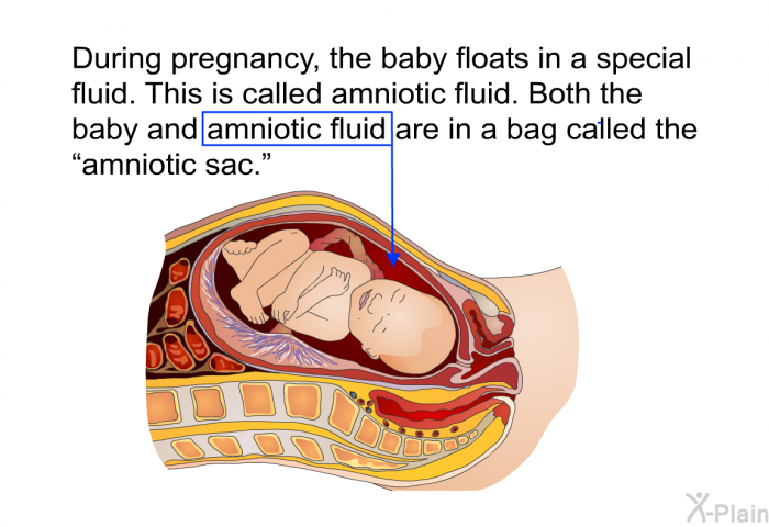 During pregnancy, the baby floats in a special fluid. This is called amniotic fluid. Both the baby and amniotic fluid are in a bag called the “amniotic sac.”