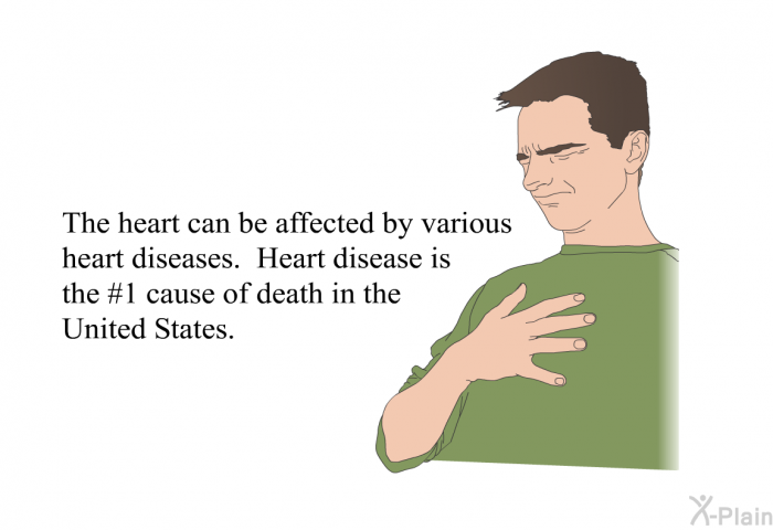 The heart can be affected by various heart diseases. Heart disease is the #1 cause of death in the United States.