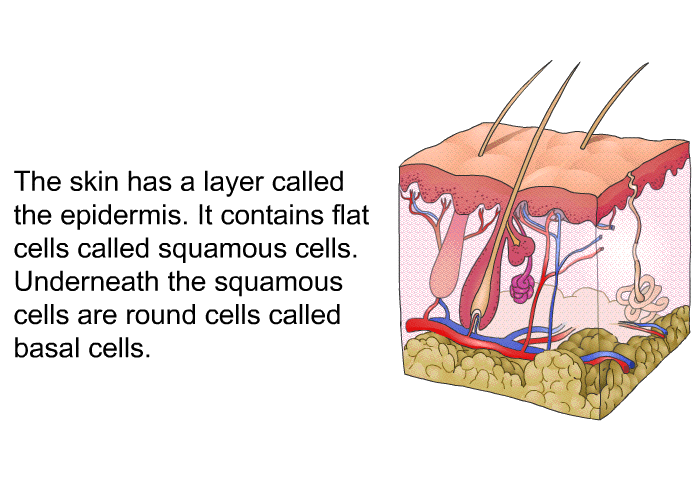 The skin has a layer called the epidermis. It contains flat cells called squamous cells. Underneath the squamous cells are round cells called basal cells.