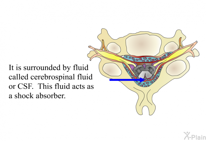 It is surrounded by fluid called cerebrospinal fluid or CSF. This fluid acts as a shock absorber.