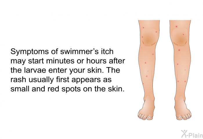 Symptoms of swimmer's itch may start minutes or hours after the larvae enter your skin. The rash usually first appears as small and red spots on the skin.