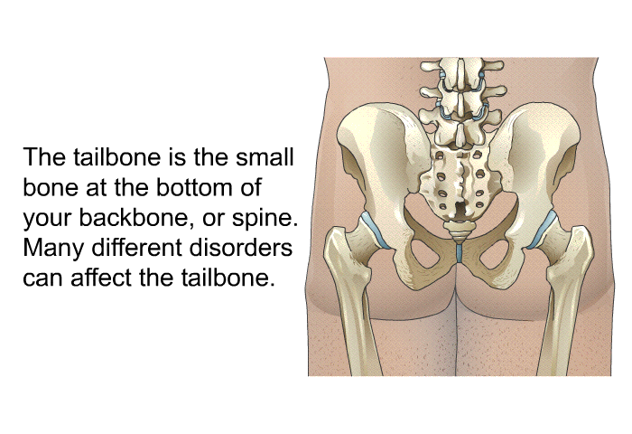 The tailbone is the small bone at the bottom of your backbone, or spine. Many different disorders can affect the tailbone.