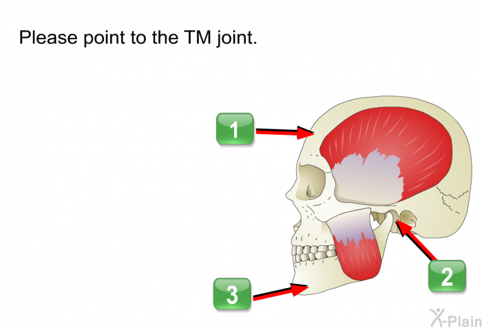 Please point to the TM joint.