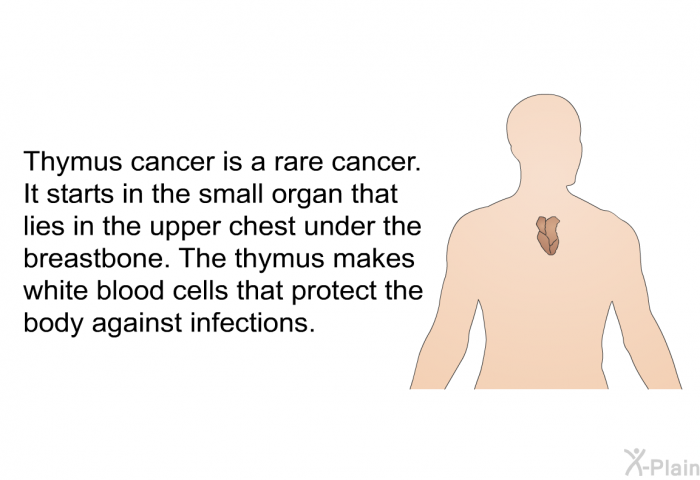 Thymus cancer is a rare cancer. It starts in the small organ that lies in the upper chest under the breastbone. The thymus makes white blood cells that protect the body against infections.