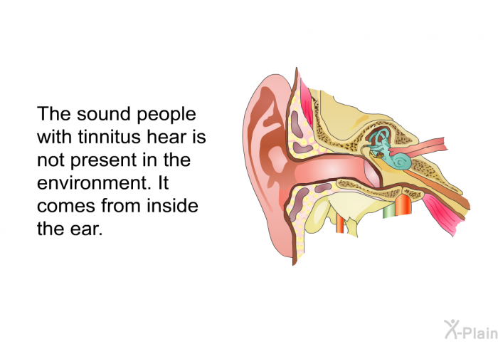 The sound people with tinnitus hear is not present in the environment. It comes from inside the ear.
