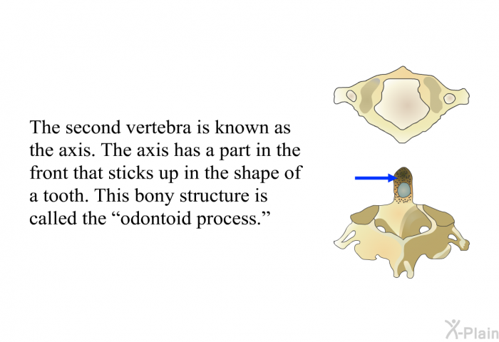 The second vertebra is known as the axis. The axis has a part in the front that sticks up in the shape of a tooth. This bony structure is called the “odontoid process.”