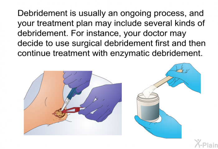 Debridement is usually an ongoing process, and your treatment plan may include several kinds of debridement. For instance, your doctor may decide to use surgical debridement first and then continue treatment with enzymatic debridement.