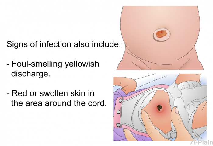 Signs of infection also include:  Foul-smelling yellowish discharge. Red or swollen skin in the area around the cord.