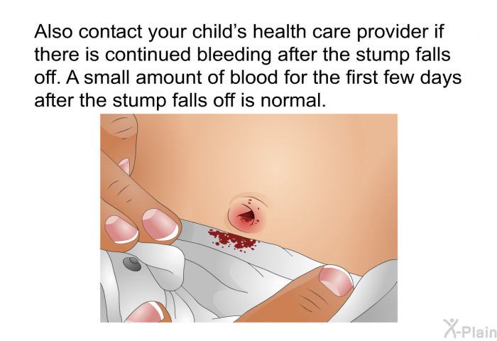 Also contact your child's health care provider if there is continued bleeding after the stump falls off. A small amount of blood for the first few days after the stump falls off is normal.