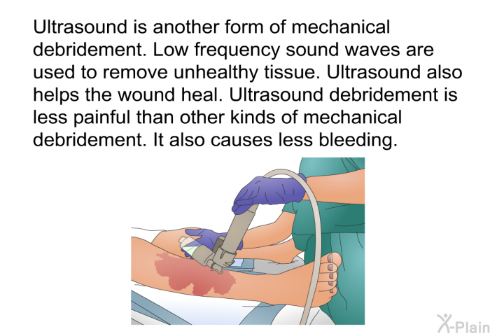 Ultrasound is another form of mechanical debridement. Low frequency sound waves are used to remove unhealthy tissue. Ultrasound also helps the wound heal. Ultrasound debridement is less painful than other kinds of mechanical debridement. It also causes less bleeding.