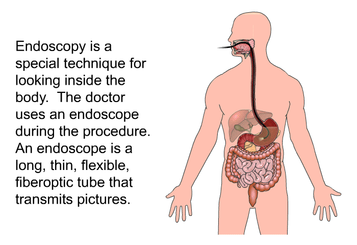 Endoscopy is a special technique for looking inside the body. The doctor uses an endoscope during the procedure. An endoscope is a long, thin, flexible, fiberoptic tube that transmits pictures.
