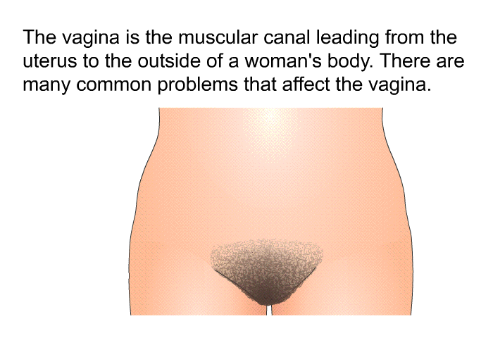 The vagina is the muscular canal leading from the uterus to the outside of a woman's body. There are many common problems that affect the vagina.