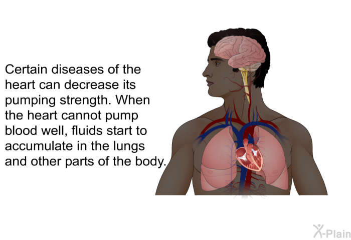 Certain diseases of the heart can decrease its pumping strength. When the heart cannot pump blood well, fluids start to accumulate in the lungs and other parts of the body.
