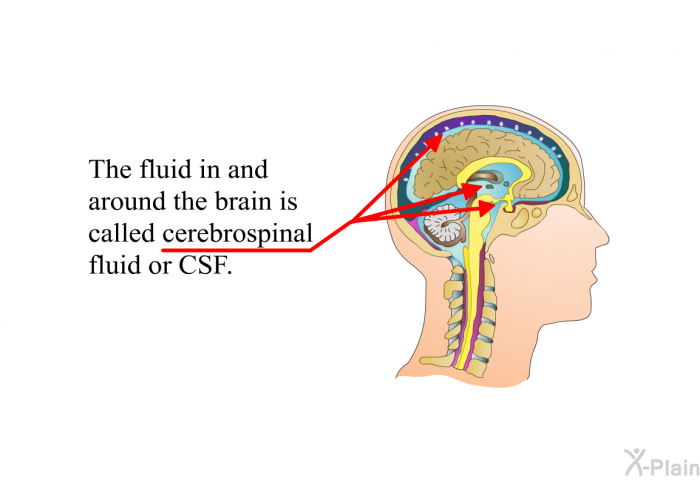 The fluid in and around the brain is called “cerebrospinal fluid” or CSF.