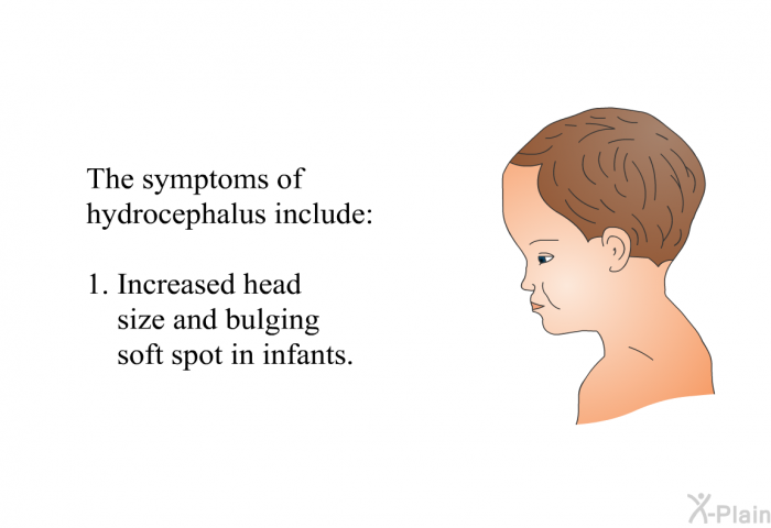 The symptoms of hydrocephalus include:  Increased head size and bulging soft spot in infants.