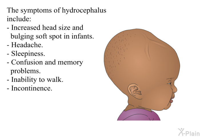 The symptoms of hydrocephalus include:  Increased head size and bulging soft spot in infants. Headache. Sleepiness. Confusion and memory problems. Inability to walk. Incontinence.