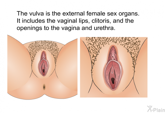 The vulva is the external female sex organs. It includes the vaginal lips, clitoris, and the openings to the vagina and urethra.