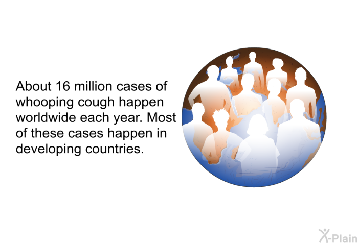 About 16 million cases of whooping cough happen worldwide each year. Most of these cases happen in developing countries.