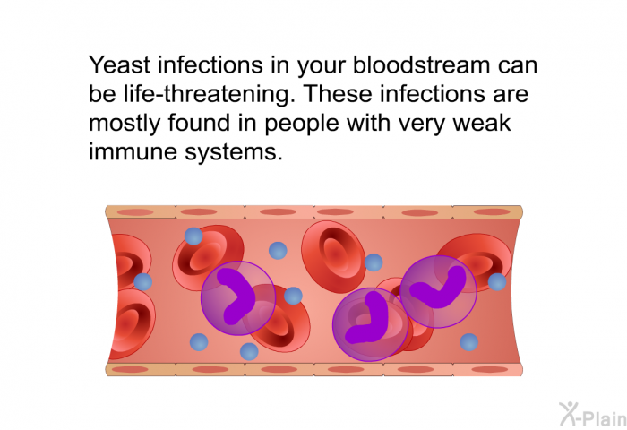 Yeast infections in your bloodstream can be life-threatening. These infections are mostly found in people with very weak immune systems.