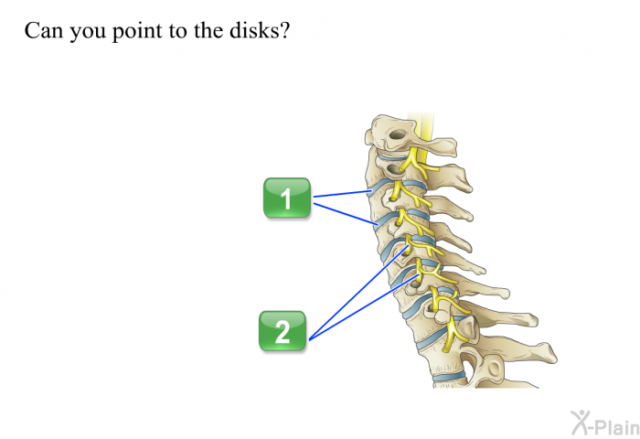 Can you point to the disks?