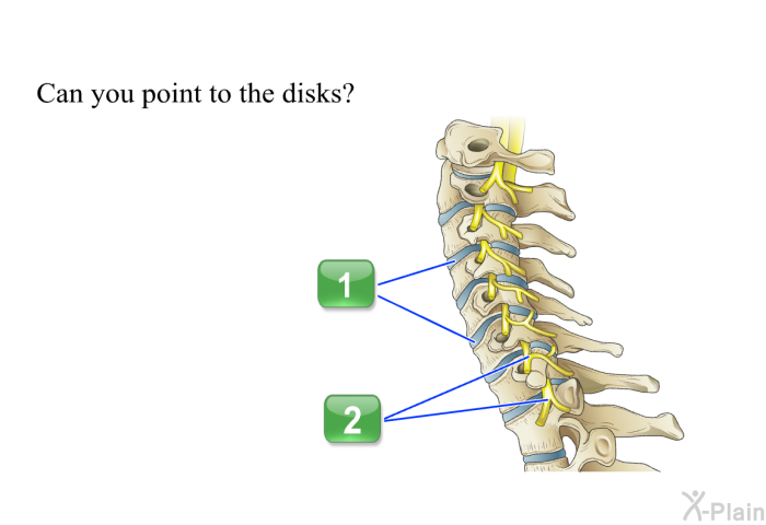 Can you point to the disks?