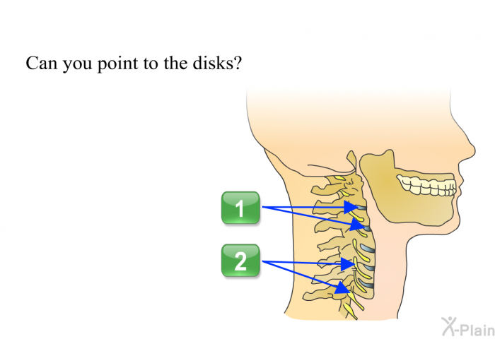 Can you point to the disks? Press A or B