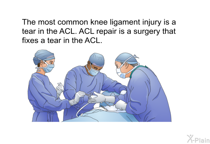 The most common knee ligament injury is a tear in the ACL. ACL repair is a surgery that fixes a tear in the ACL.