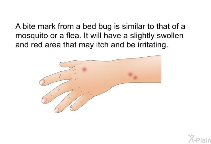 A bite mark from a bed bug is similar to that of a mosquito or a flea. It will have a slightly swollen and red area that may itch and be irritating.