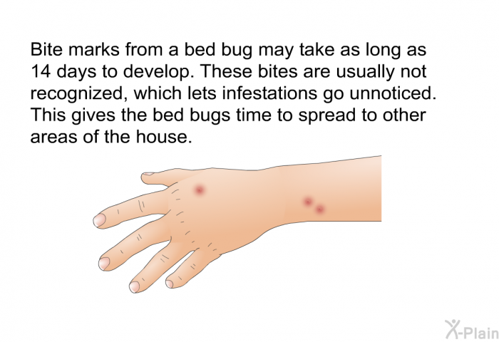 Bite marks from a bed bug may take as long as 14 days to develop. These bites are usually not recognized, which lets infestations go unnoticed. This gives the bed bugs time to spread to other areas of the house.