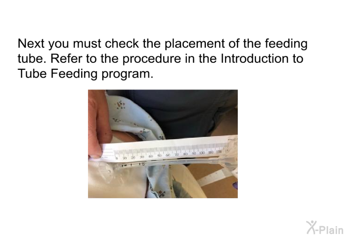 Next you must check the placement of the feeding tube. Refer to the procedure in the Introduction to Tube Feeding program.