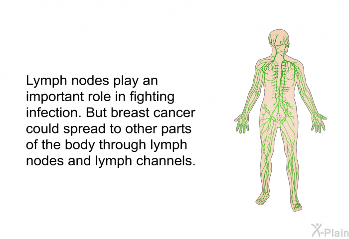 Lymph nodes play an important role in fighting infection. But breast cancer could spread to other parts of the body through lymph nodes and lymph channels.