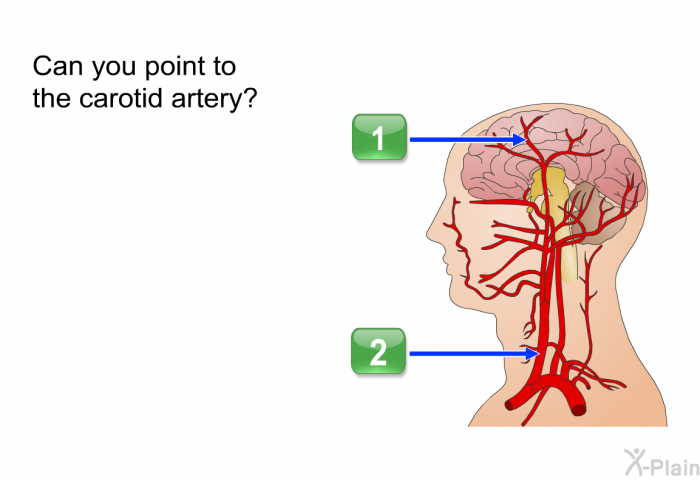 Can you point to the carotid artery?