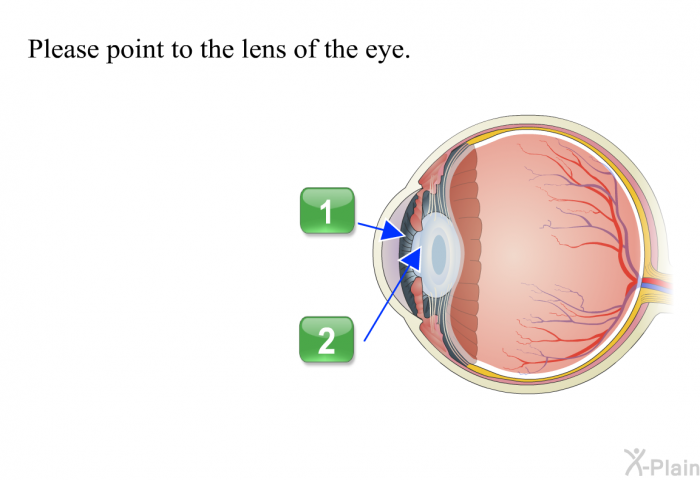 Please point to the lens of the eye. Press A or B