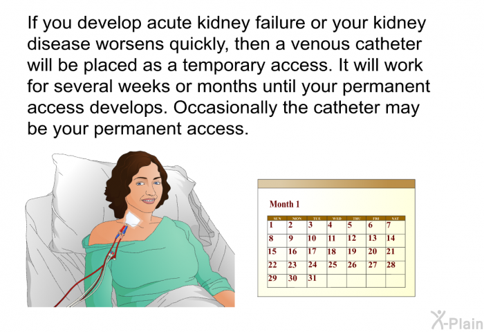 If you develop acute kidney failure or your kidney disease worsens quickly, then a venous catheter will be placed as a temporary access. It will work for several weeks or months until your permanent access develops. Occasionally the catheter may be your permanent access.