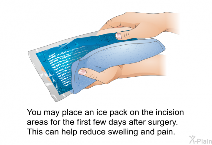 You may place an ice pack on the incision areas for the first few days after surgery. This can help reduce swelling and pain.