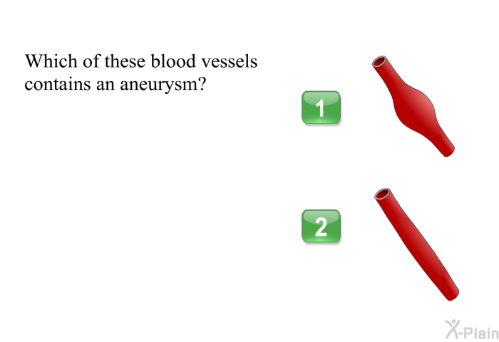 Which of these blood vessels contains an aneurysm?