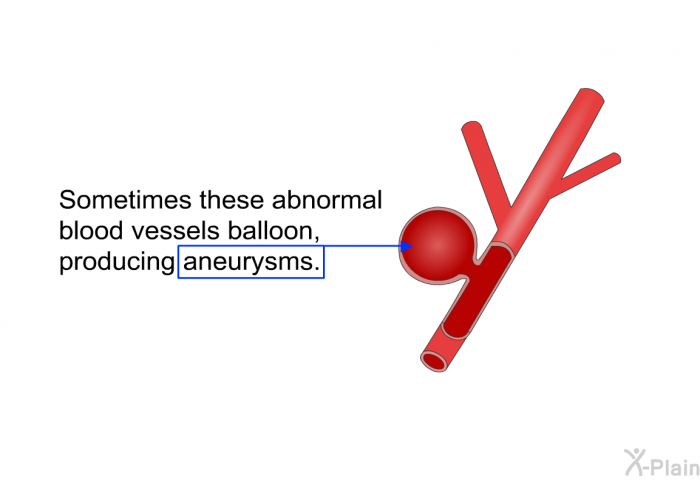 Sometimes these abnormal blood vessels balloon, producing aneurysms.