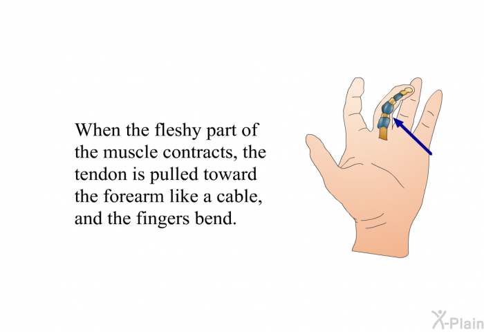 When the fleshy part of the muscle contracts, the tendon is pulled toward the forearm like a cable, and the fingers bend.