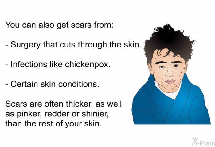 You can also get scars from:  Surgery that cuts through the skin. Infections like chickenpox. Certain skin conditions.  
Scars are often thicker, as well as pinker, redder or shinier, than the rest of your skin.