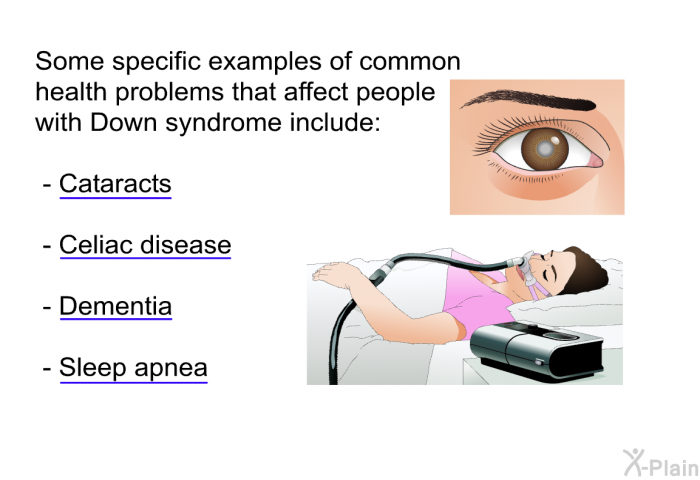 Some specific examples of common health problems that affect people with Down syndrome include:  Cataracts Celiac disease Dementia Sleep apnea