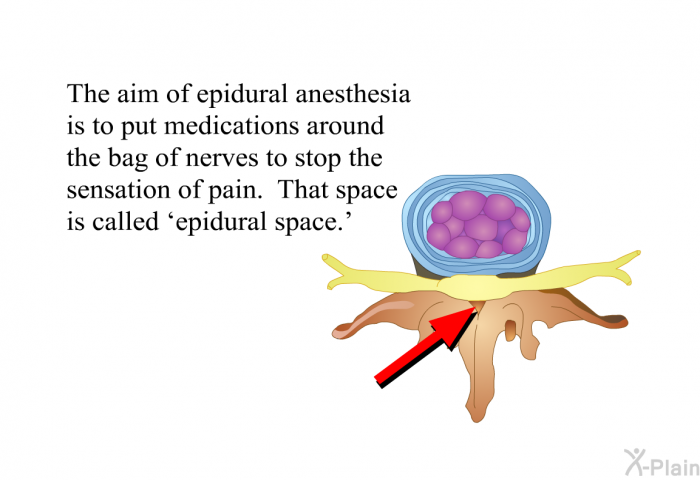 The aim of epidural anesthesia is to put medications around the bag of nerves to stop the sensation of pain. That space is called  epidural space.'