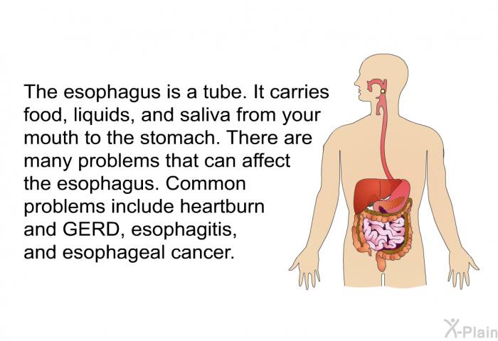 The esophagus is a tube. It carries food, liquids, and saliva from your mouth to the stomach. There are many problems that can affect the esophagus. Common problems include heartburn and GERD, esophagitis, and esophageal cancer.