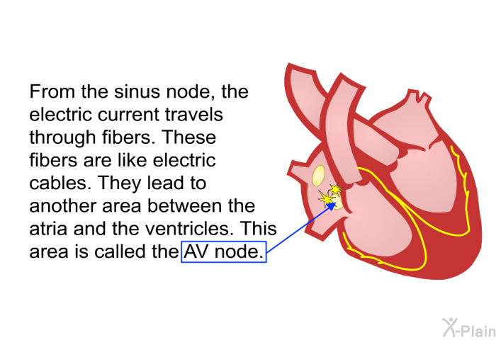 From the sinus node, the electric current travels through fibers. These fibers are like electric cables. They lead to another area between the atria and the ventricles. This area is called the AV node.