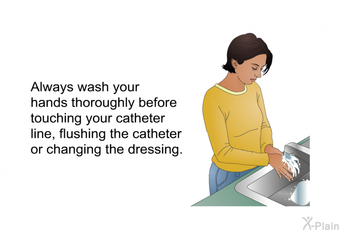 Always wash your hands thoroughly before touching your catheter line, flushing the catheter or changing the dressing.