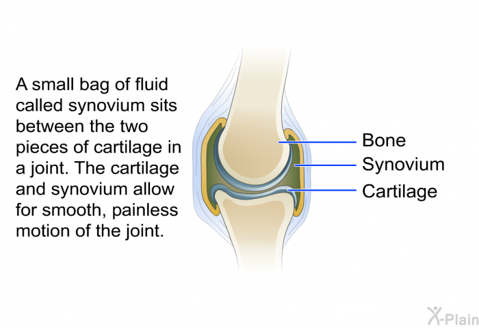 A small bag of fluid called synovium sits between the two pieces of cartilage in a joint. The cartilage and synovium allow for smooth, painless motion of the joint.