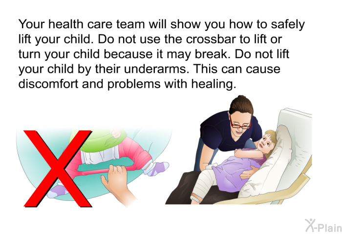 Your health care team will show you how to safely lift your child. Do not use the crossbar to lift or turn your child because it may break. Do not lift your child by their underarms. This can cause discomfort and problems with healing.