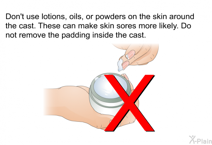 Don't use lotions, oils, or powders on the skin around the cast. These can make skin sores more likely. Do not remove the padding inside the cast.