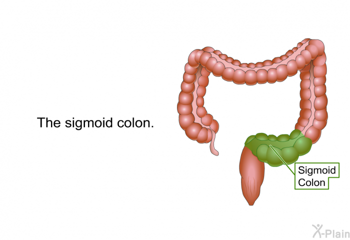 The sigmoid colon.