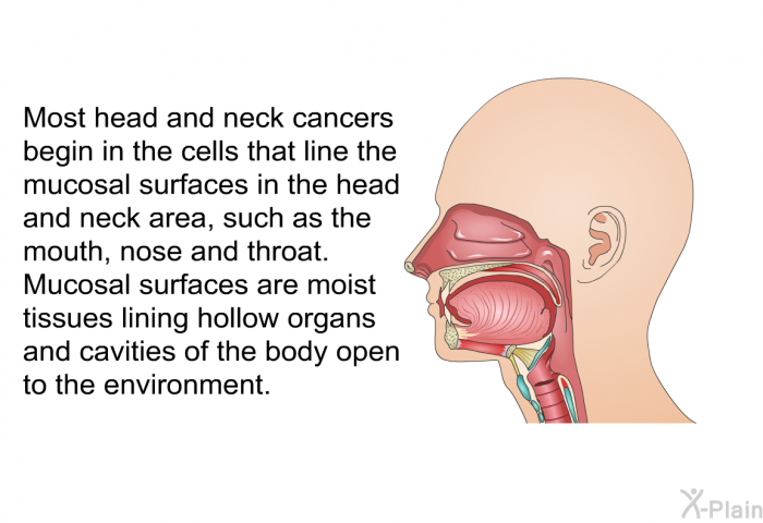 Most head and neck cancers begin in the cells that line the mucosal surfaces in the head and neck area, such as the mouth, nose, and throat. Mucosal surfaces are moist tissues lining hollow organs and cavities of the body open to the environment.