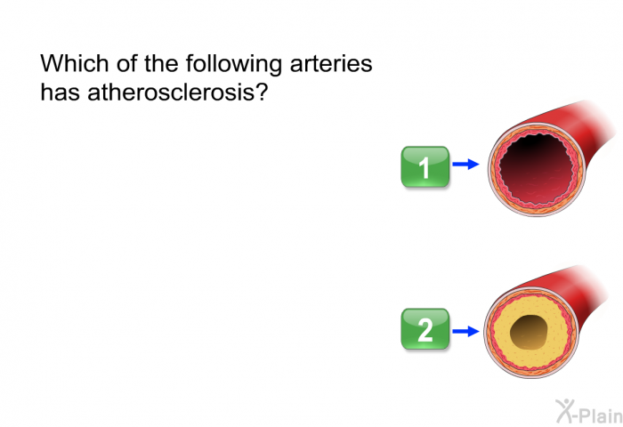 Which of the following arteries has atherosclerosis?